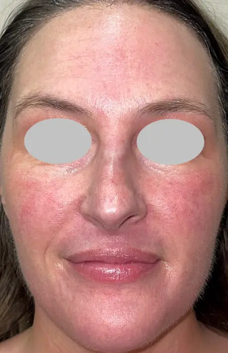 Screenshot-2025-07-02-at-3.38.37 PM