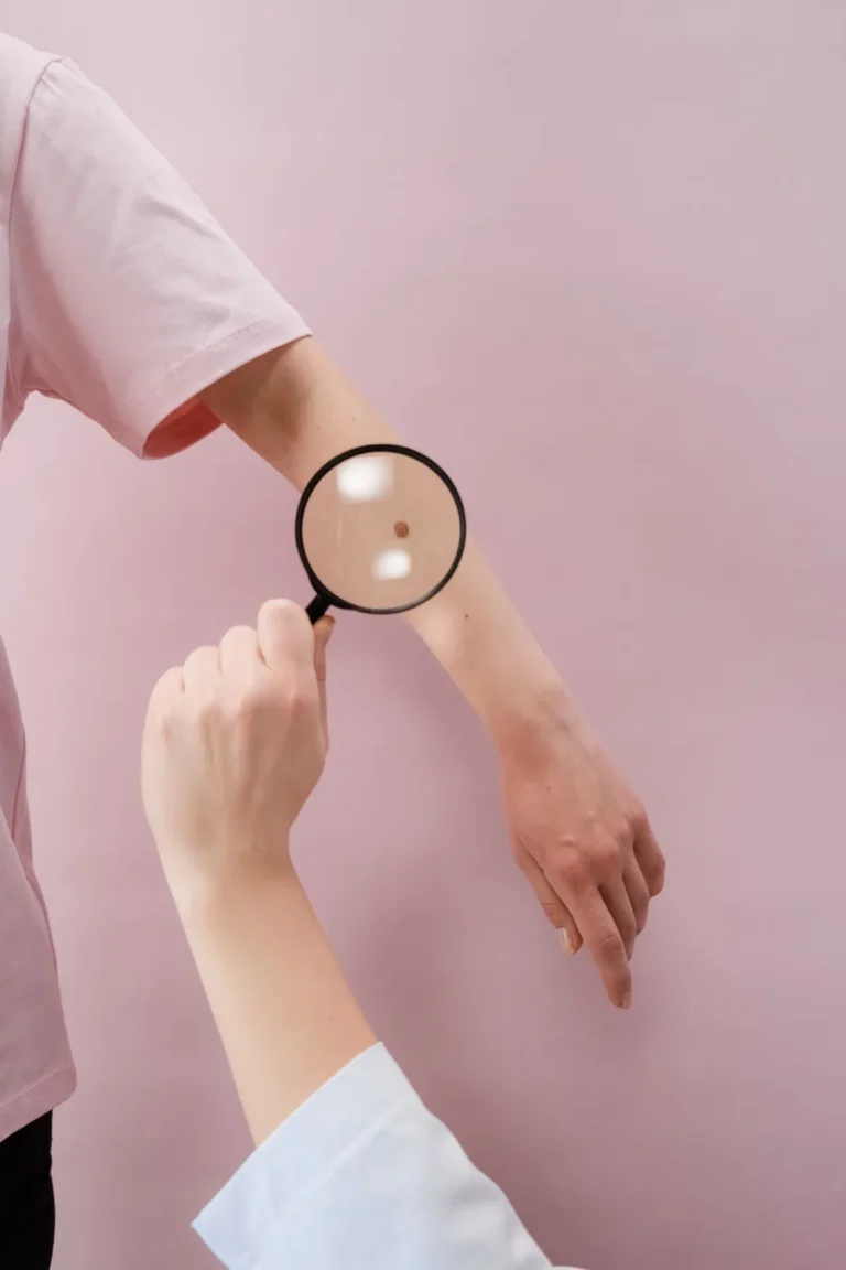 Common Types of Skin Cancer: A Complete Guide From Basal Cell to Melanoma